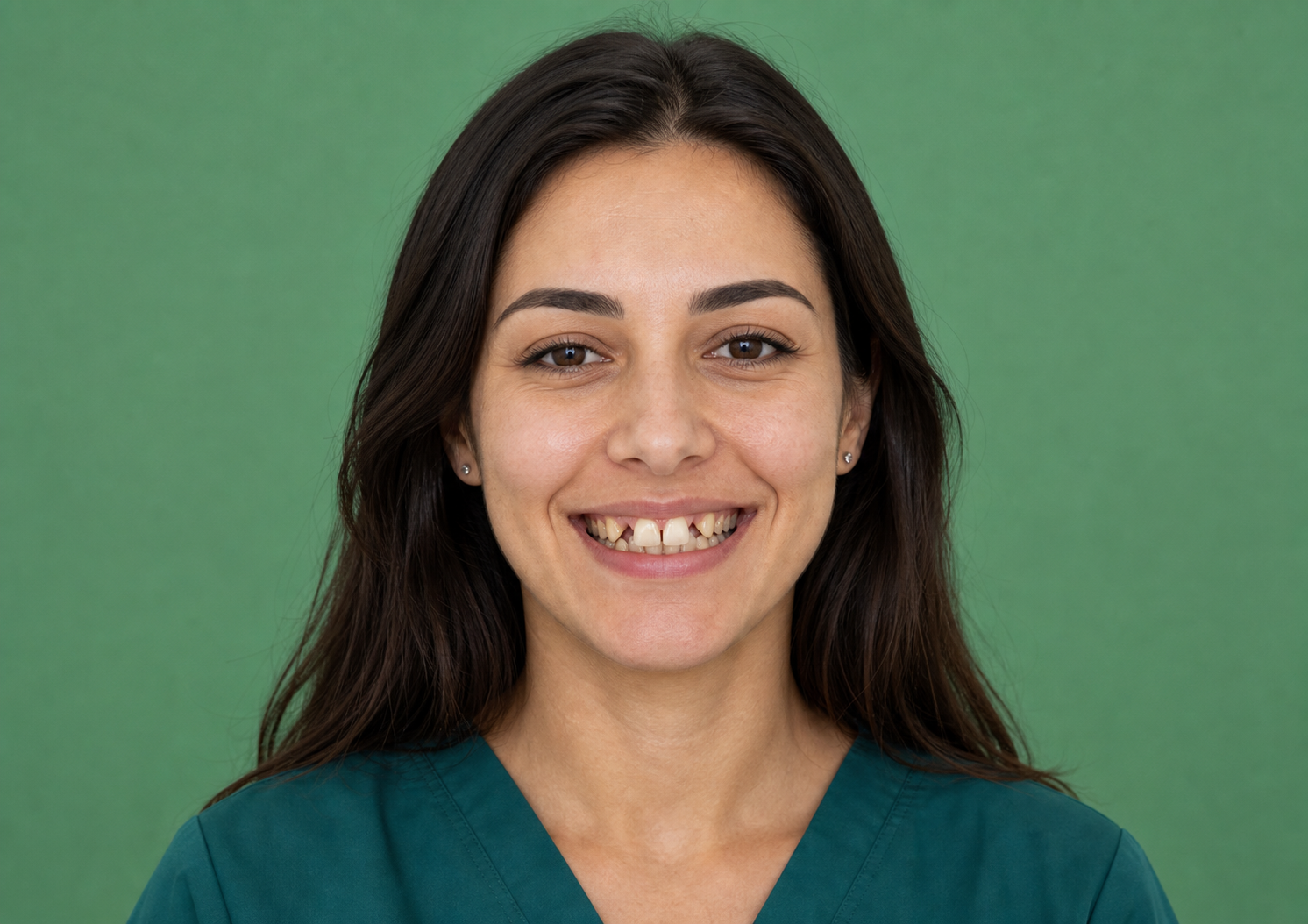 After - Smile Design