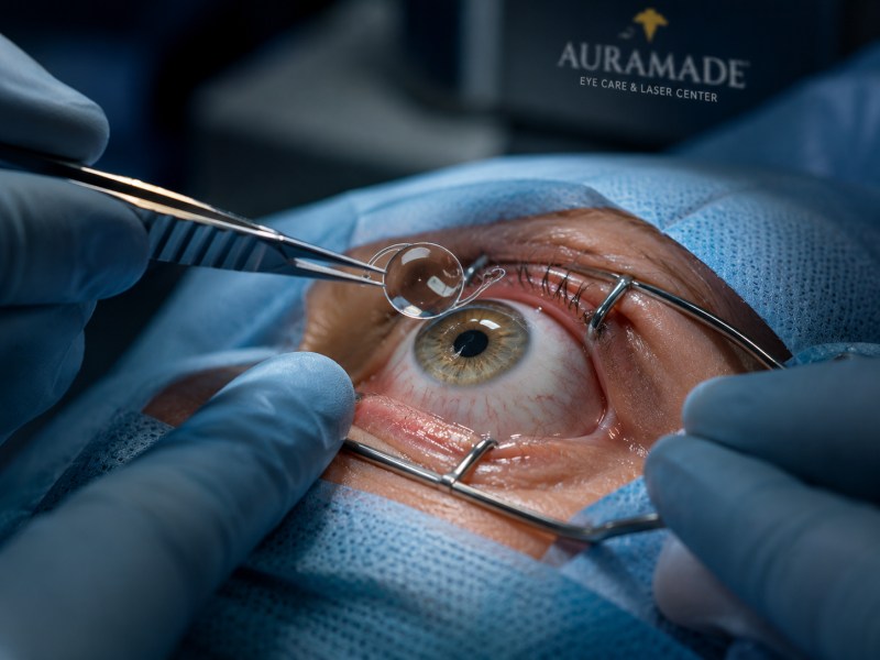 Smart Lens Surgery